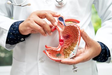 Stomach disease, doctor holding anatomy model for study diagnosis and treatment in hospital.