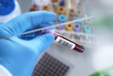 UK, Buckinghamshire, High Wycombe, Scientist holding hematology test vial