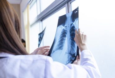 Senior doctor woman teaching doctor student woman. How to analyze the X-ray film. Radiology department.